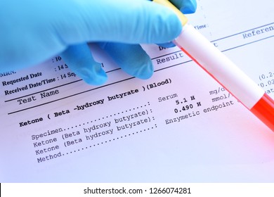 Abnormal High Ketone Test Result With Blood Sample Tube