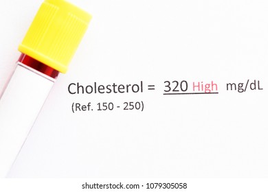 Blood Sample Tube Abnormal High Hba1c Stock Photo (Edit Now) 1477833143