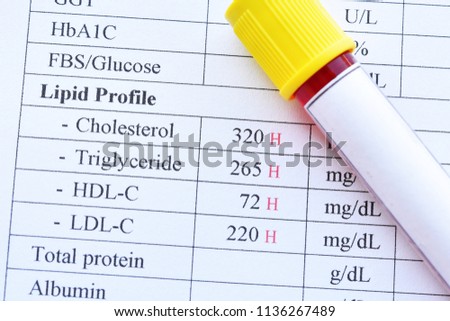 Abnormal high lipid test result with blood sample tube
