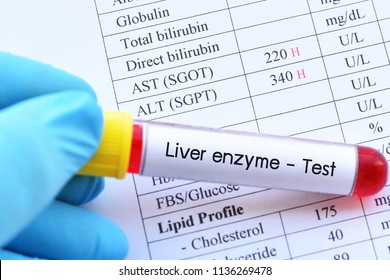 Abnormal High Liver Enzyme Test Result With Blood Sample Tube