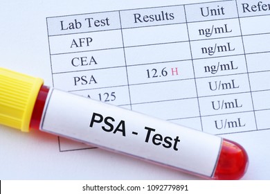 Abnormal high PSA test result with blood sample 