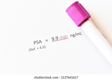 Abnormal high PSA test result with blood sample tube