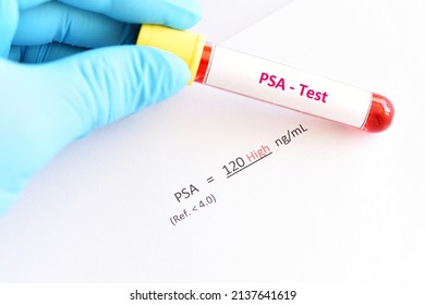 Abnormal high PSA test result with blood sample tube
