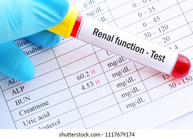 Abnormal High Renal Function Test Results With Blood Sample Tube