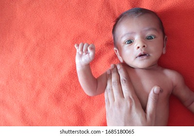 Abnormal Mentally Challenged Malnourished Baby Looking At The Camera Lying On Orange Red Velvet Cloth Background. Protein Energy Malnutrition Concept