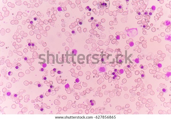 Abnormal Red Blood Cells Moderate Nucleated Stock Photo Edit Now