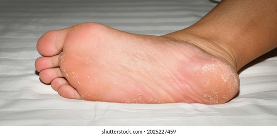 Best mature rough heels wrinkled soles fan images