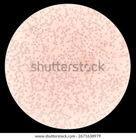 Abnormal structural  RBC, RBC diseases with high platelet count under microscopic examination of hematological stained slide.