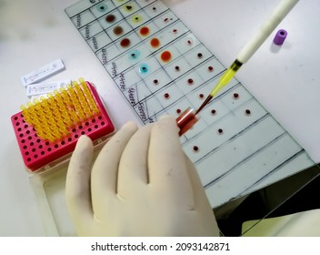 ABO blood grouping by slide test technique. Technician performing blood grouping.