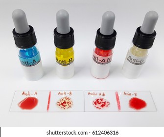 ABO blood grouping by slide agglutination method it's present Blood group B and Rhesus (D) positive and 4 monoclonal antibody for detect the blood grouping system. 
