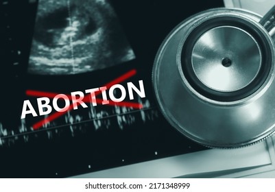 The Abortion Ban Law. Stop Illegal Healthcare. Save Baby Life. Abortion Ruling. Anti-abortion Movement. Stethoscope And Ultrasound Scan Picture Of Pregnancy And Fetus. Moral And Ethical Concepts.