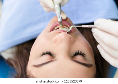 Above view of young patient at dentist office, getting her teeth polished with prophylactic paste. - Shutterstock ID 1185523879