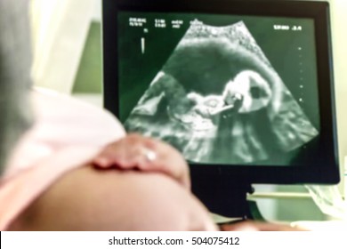 Abstract, wazig, bokeh achtergrond, afbeelding voor de achtergrond. Zwangere vrouw en partner met 4D Ultrasound Scan