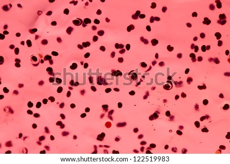 Abstract macro image of particles in gel looking like bacteria