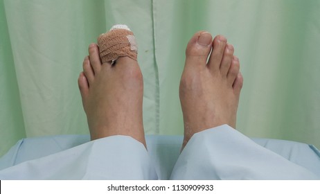 Accident Bone Broken In My Toe