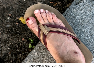 cut on heel of foot