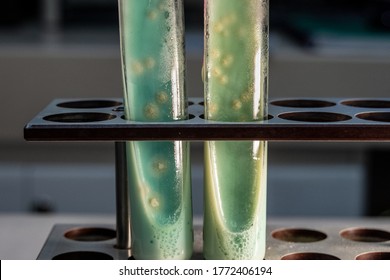 Acid Fast Bacilli In Culture Tubes With Mycobacterium Tuberculosis