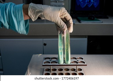 Acid Fast Bacilli In Culture Tubes With Mycobacterium Tuberculosis