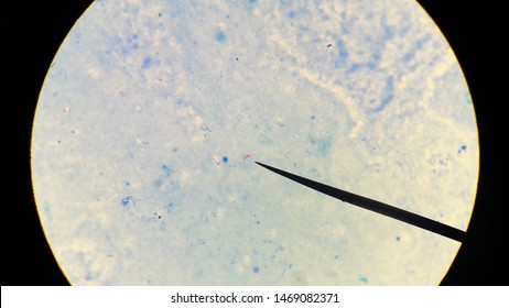 Acid-fast Bacilli Bacteria In Sputum