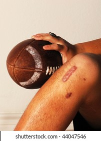 ACL Knee Football Injury