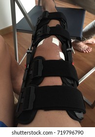 ACL Reconstruction