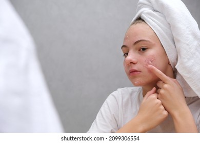 Acne. A teenage girl applying acne medication on her face in front of a mirror. Care for problem skin