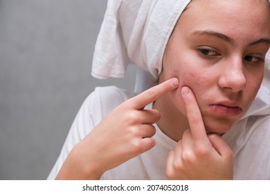 Acne. A teenage girl squeezing out a pimples on her face in front of a mirror. Problematic skin in adolescence. skin care - Shutterstock ID 2074052018