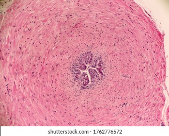 Ductus Deferens Images Stock Photos Vectors Shutterstock