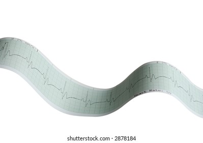 Actual EKG Tape