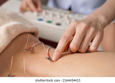 Acupuncture electrical stimulation for woman back to relieve pain.