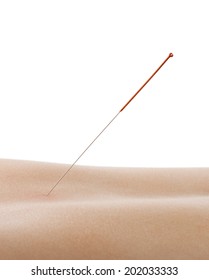 acupuncture, needle in skin dorsum, on white background, isolated