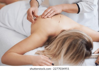 A acupuncture needle therapy in the studio - Powered by Shutterstock