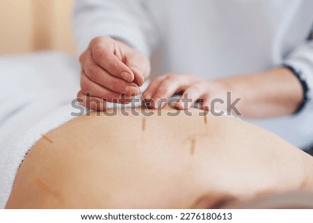 A acupuncture needle therapy in the studio
