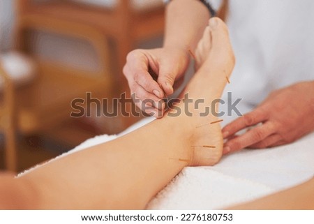 A acupuncture needle therapy in the studio