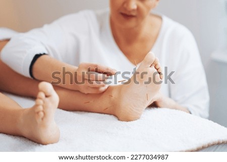 A acupuncture needle therapy in the studio