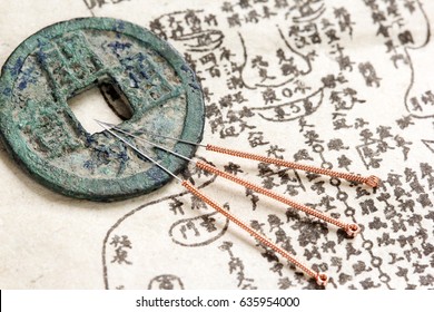 Akupunktur-Nadeln und antike Abbildung von Akupunkturpunkten am menschlichen Körper (Übersetzung: Alle Zeichen sind kein Text, sondern einzelne Namen jedes Akupunkturpunktes.)