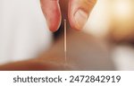 Acupuncture, needles and skin with hand in closeup, alternative medicine or healing therapy. Relax, muscle and body pain in clinic for health or wellness, support for immune system or stress injury