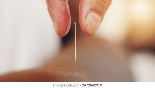 Acupuncture, needles and skin with hand in closeup, alternative medicine or healing therapy. Relax, muscle and body pain in clinic for health or wellness, support for immune system or stress injury - Powered by Shutterstock