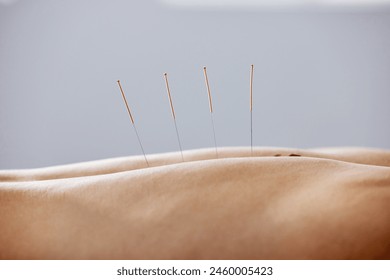 Acupuncture, needles and treatment of body in healthcare, healing muscle and back pain relief. Patient, anatomy and dry needling physiotherapy to relax person at salon and holistic care for injury. - Powered by Shutterstock