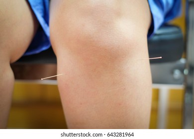 Acupuncture Point At Knee For Pain Therapy 