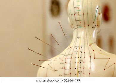 Acupuncture In The Therapy Of Pain