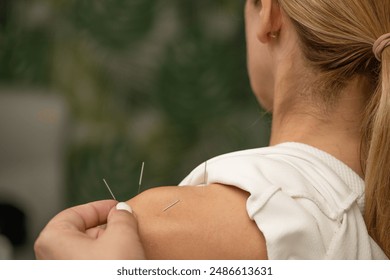 Acupuncture treatment for chronic shoulder pain - Powered by Shutterstock