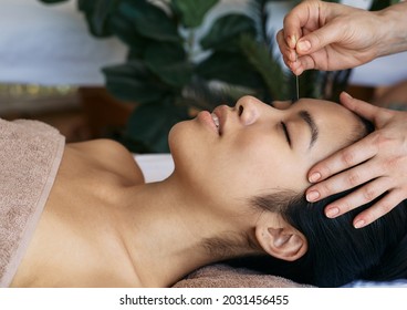 Acupuncture treatment for migraines and headaches. Close-up of reflexologist hand with acupuncture needle near asian woman's forehead - Powered by Shutterstock