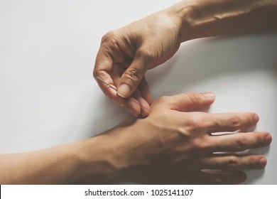 Acupuncture Treatment On Patient Hand.