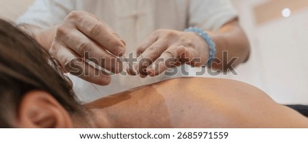 Acupuncturist carefully inserting thin needles into a patient's back during an alternative medicine treatment session for wellness and traditional chinese therapy