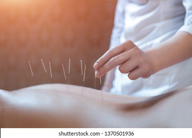 Acupuncturist Doctor Makes A Therapy For Woman;