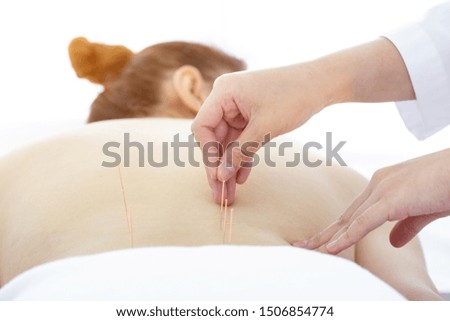 Acupuncturist will insert needles into a person's back skin to reduce back pain.