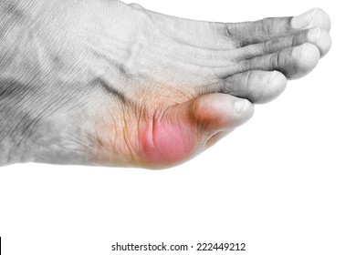 acute foot pain