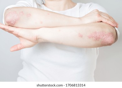 Abnormally Large Arm Images Stock Photos Vectors Shutterstock