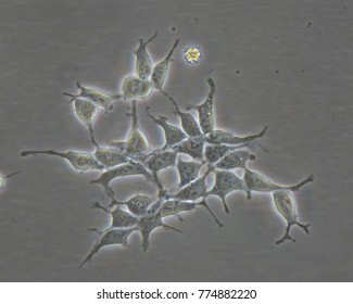 Adherents Cells In Cell Culture Flask. Microscope Camera.